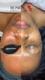 Dark Spot Corrector